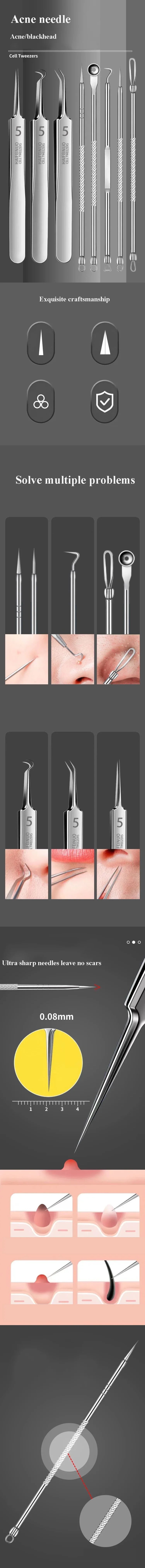 3-8Pcs Blackhead Clip Pimples Tweezer Blackhead Remover Stainless Steel Cell Clip Beauty Product Acne Needle Skin Cleanning Tool